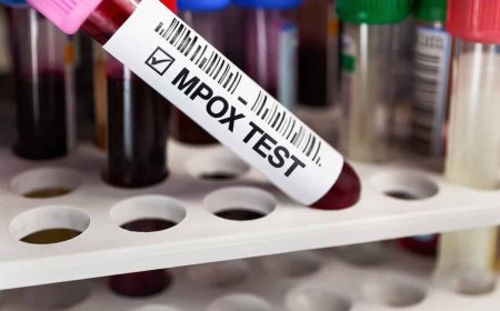 Primeiro caso de mpox é confirmado no Brasil