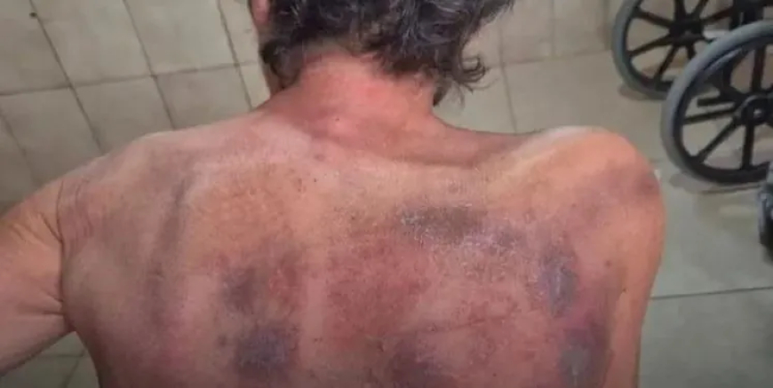 Polícia Civil investiga denúncia de maus-tratos a idosos que vivem em asilo em Arceburgo