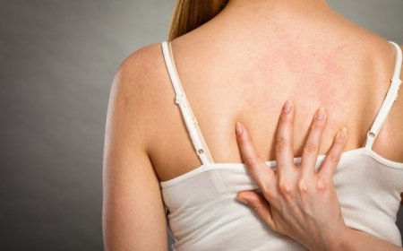 SUS passa a oferecer tratamento integral para dermatite atópica