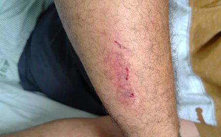 Motorista de ônibus escolar de Conceição da Aparecida é agredido com pá pelo Secretário de Transportes Municipal