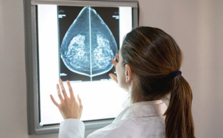 SUS amplia acesso à mamografia a mulheres de 40 a 49 anos