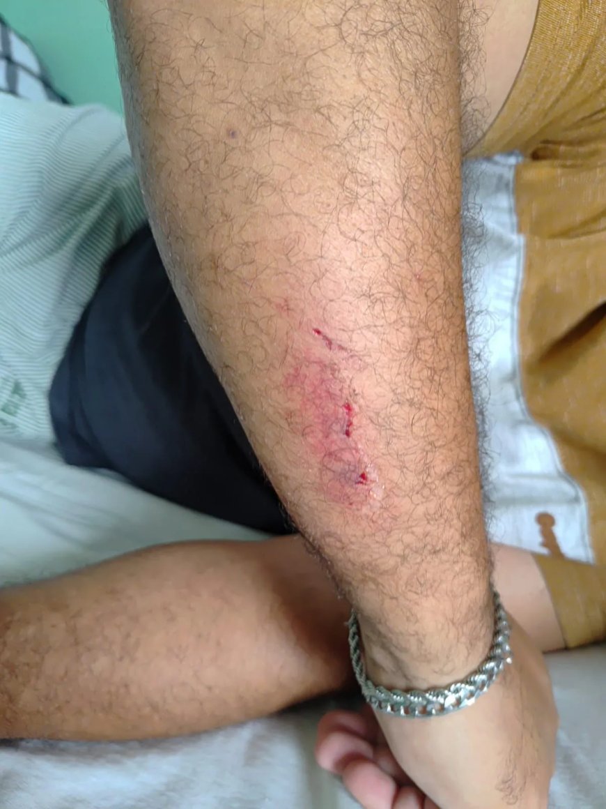 Motorista de ônibus escolar de Conceição da Aparecida é agredido com pá pelo Secretário de Transportes Municipal