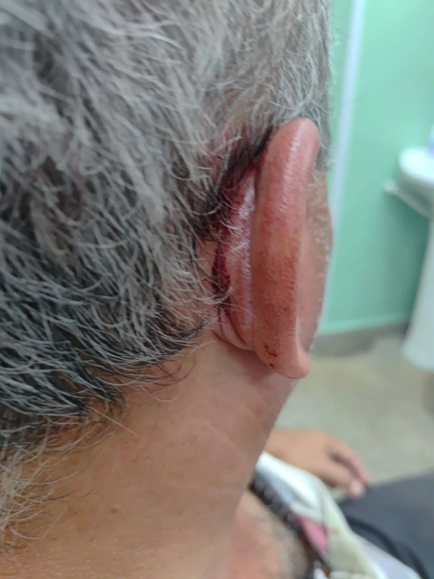 Motorista de ônibus escolar de Conceição da Aparecida é agredido com pá pelo Secretário de Transportes Municipal