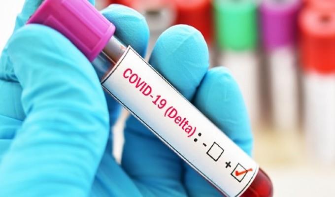 Covid-19: Primeiro caso de contaminação com a Variante Delta é confirmado no Sul de Minas